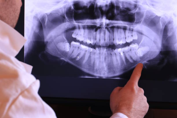 Best Knocked-Out Tooth Emergency  in East Cleveland, TN