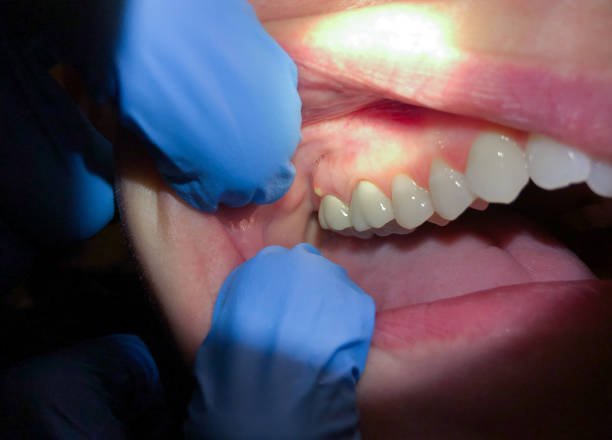 Best Broken Tooth Emergency  in East Cleveland, TN